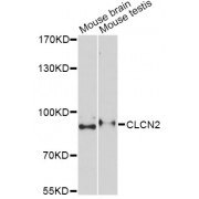 Western blot analysis of extracts of various cell lines, using CLCN2 Antibody (abx004684) at 1/1000 dilution.