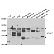 Western blot analysis of extracts of various cell lines, using KCNN3 antibody (abx004688) at 1/1000 dilution.