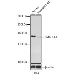 SWI/SNF Related, Matrix Associated, Actin Dependent Regulator of Chromatin Subfamily C Member 1 (SMARCC1) Antibody