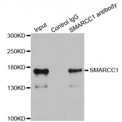 SWI/SNF Related, Matrix Associated, Actin Dependent Regulator of Chromatin Subfamily C Member 1 (SMARCC1) Antibody