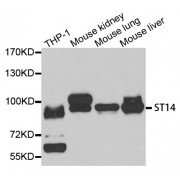 Western blot analysis of extracts of various cell lines, using ST14 antibody (abx004692) at 1/1000 dilution.