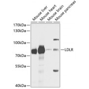 Western blot analysis of extracts of various cell lines, using IL31RA antibody (abx004697) at 1/1000 dilution.