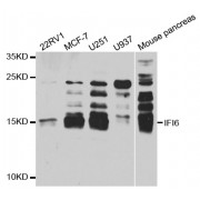 Western blot analysis of extracts of various cell lines, using IFI6 antibody (abx004709) at 1/1000 dilution.