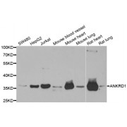 Western blot analysis of extracts of various cell lines, using ANKRD1 antibody (abx004731) at 1/1000 dilution.