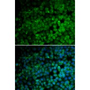Immunofluorescence analysis of HeLa cells using TRIM13 antibody (abx004755). Blue: DAPI for nuclear staining.