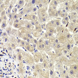 Proline-Rich AKT1 Substrate 1 (AKT1S1) Antibody