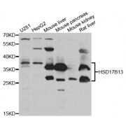 Western blot analysis of extracts of various cell lines, using HSD17B13 antibody (abx004778) at 1/1000 dilution.