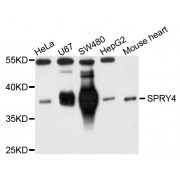 Western blot analysis of extracts of various cell lines, using SPRY4 antibody (abx004783) at 1/1000 dilution.