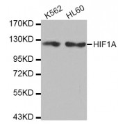 Western blot analysis of extracts of various cell lines, using HIF1A antibody (abx004785).