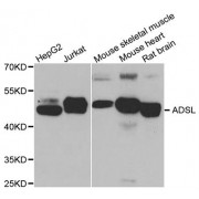 Western blot analysis of extracts of various cell lines, using ADSL antibody (abx004797) at 1/1000 dilution.
