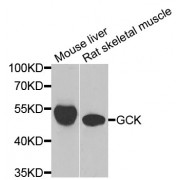 Western blot analysis of extracts of various cell lines, using GCK antibody (abx004809) at 1/1000 dilution.