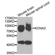 Western blot analysis of extracts of various cell lines, using KCNA2 antibody (abx004811) at 1/1000 dilution.