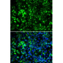 Potassium Voltage-Gated Channel Subfamily A Member 2 (KCNA2) Antibody