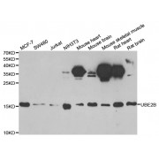 Western blot analysis of extracts of various cell lines, using UBE2B antibody (abx004827) at 1/1000 dilution.