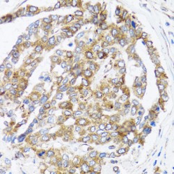 B-Cell Receptor Associated Protein 29 (BCAP29) Antibody