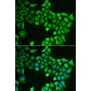 Immunofluorescence analysis of HeLa cells using ASL antibody (abx004859). Blue: DAPI for nuclear staining.