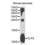 Western blot analysis of extracts of mouse pancreas, using CLPS antibody (abx004864) at 1/1000 dilution.