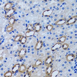 Inositol Monophosphatase 1 (IMPA1) Antibody