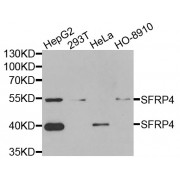 Western blot analysis of extracts of various cell lines, using SFRP4 antibody (abx004903) at 1/1000 dilution.