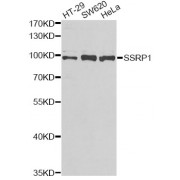 Western blot analysis of extracts of various cell lines, using SSRP1 antibody (abx004907) at 1/1000 dilution.