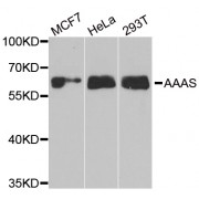 Western blot analysis of extracts of various cell lines, using AAAS antibody (abx004920) at 1/1000 dilution.