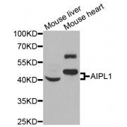 Western blot analysis of extracts of various cell lines, using AIPL1 antibody (abx004950) at 1/1000 dilution.
