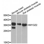 Western blot analysis of extracts of various cell lines, using MYOZ2 antibody (abx004959) at 1/1000 dilution.