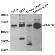 Western blot analysis of extracts of various cell lines, using SMYD2 antibody (abx004964) at 1/1000 dilution.