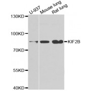 Western blot analysis of extracts of various cell lines, using KIF2B antibody (abx004968) at 1/1000 dilution.