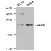 Western blot analysis of extracts of various cell lines, using CGB5 antibody (abx004973) at 1/1000 dilution.