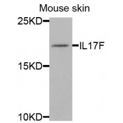 Western blot analysis of extracts of mouse skin, using IL17F antibody (abx004974) at 1/1000 dilution.