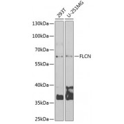 Western blot analysis of extracts of various cell lines, using FLCN antibody (abx004978) at 1/1000 dilution. Secondary antibody: HRP Goat Anti-Rabbit IgG (H+L) at 1/10000 dilution.