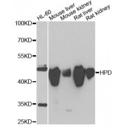 Western blot analysis of extracts of various cell lines, using HPDL antibody (abx004989) at 1/1000 dilution.