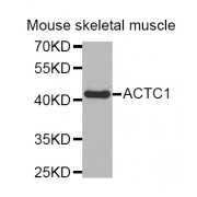 Western blot analysis of extracts of mouse skeletal muscle, using ACTC1 antibody (abx004990).