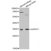 Western blot analysis of extracts of various cell lines, using AGPAT1 antibody (abx004997) at 1/1000 dilution.