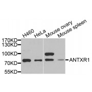 Western blot analysis of extracts of various cell lines, using ANTXR1 antibody (abx005005) at 1/1000 dilution.
