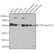 Western blot analysis of extracts of various cell lines, using CCT2 antibody (1/1000 dilution).