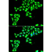 Immunofluorescence analysis of HeLa cells using CLDN2 antibody (abx005034). Blue: DAPI for nuclear staining.
