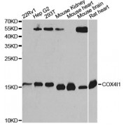 Western blot analysis of extracts of various cell lines, using COX4I1 Antibody (abx005037) at 1/1000 dilution.