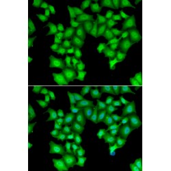 Cleavage And Polyadenylation-Specific Factor 3-Like Protein (CPSF3L) Antibody