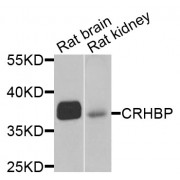 Western blot analysis of extracts of various cell lines, using CRHBP antibody (abx005040) at 1/1000 dilution.
