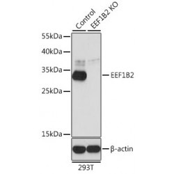 Elongation Factor 1-Beta (EEF1B2) Antibody