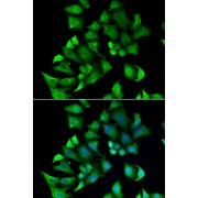 Immunofluorescence analysis of A549 cells using ENTPD2 antibody (abx005050). Blue: DAPI for nuclear staining.