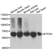 Western blot analysis of extracts of various cell lines, using ETFDH antibody (abx005051) at 1/1000 dilution.