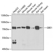 Western blot analysis of extracts of various cell lines, using GBE1 antibody (abx005061) at 1/1000 dilution.