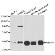 Western blot analysis of extracts of various cell lines, using GDAP1 antibody (abx005062) at 1/1000 dilution.