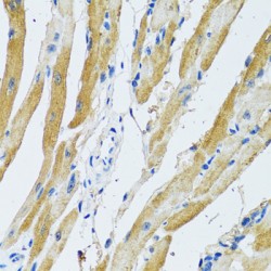 Ganglioside-Induced Differentiation-Associated Protein 1 (GDAP1) Antibody