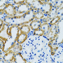 Ganglioside-Induced Differentiation-Associated Protein 1 (GDAP1) Antibody