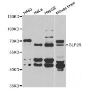 Western blot analysis of extracts of various cell lines, using GLP2R antibody (abx005063) at 1/1000 dilution.