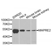Western blot analysis of extracts of various cell lines, using MAPRE2 antibody (abx005096) at 1/1000 dilution.